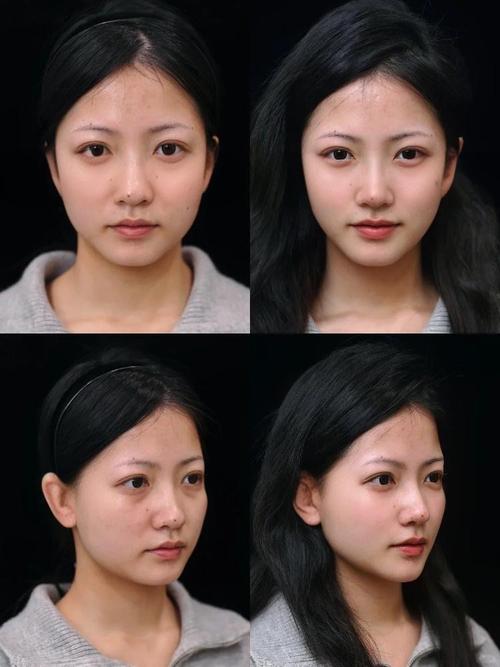 整容天后在线观影_整容天后在线观看中字_整容天后免费中字